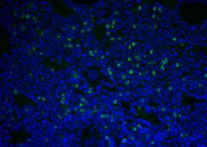 Tunel（荧光）检测