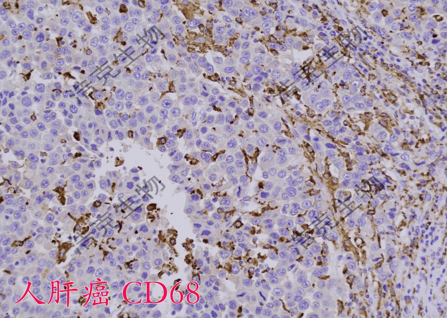 免疫组化-杭州浩克生物