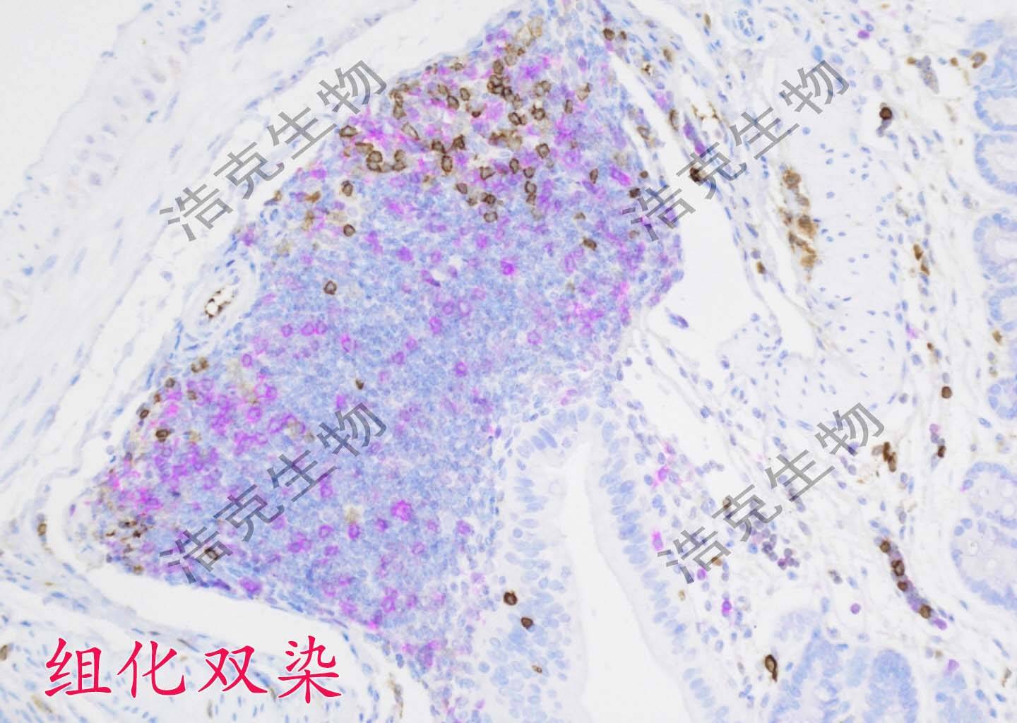 免疫组化双染-杭州浩克生物