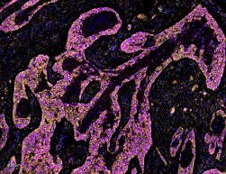 免疫熒光雙標(biāo)（芯片）