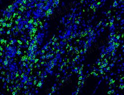 免疫熒光單標(biāo)（芯片）