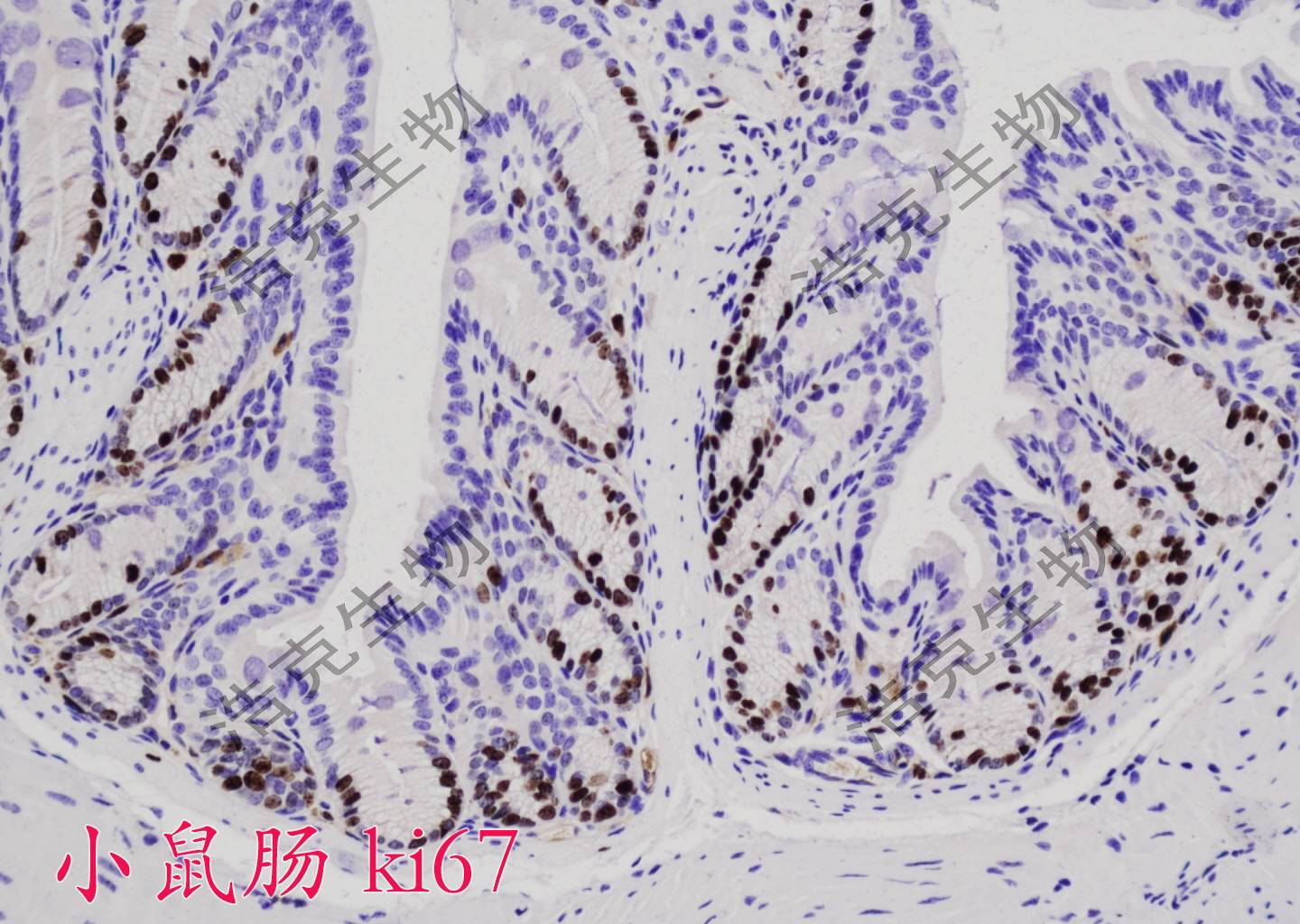 免疫组化-杭州浩克生物