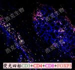 荧光扫描（四标）