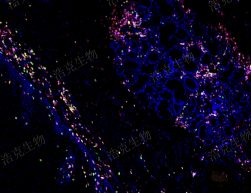 免疫熒光四標(biāo)（芯片）