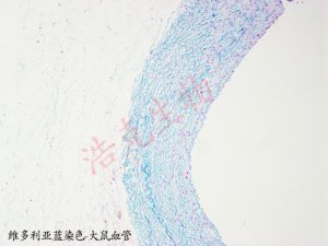 維多利亞藍(lán)染色 維多利亞藍(lán)染色