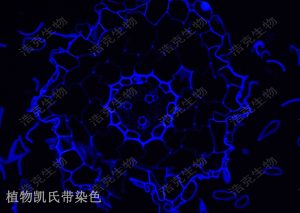 凱氏帶染色 凱氏帶染色