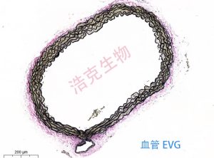 EVG染色 EVG染色