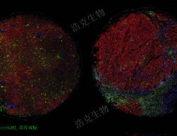 免疫熒光雙標(biāo)（芯片）