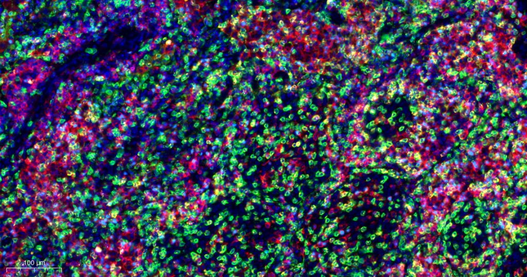免疫熒光四標(biāo)+DAPI（五色）