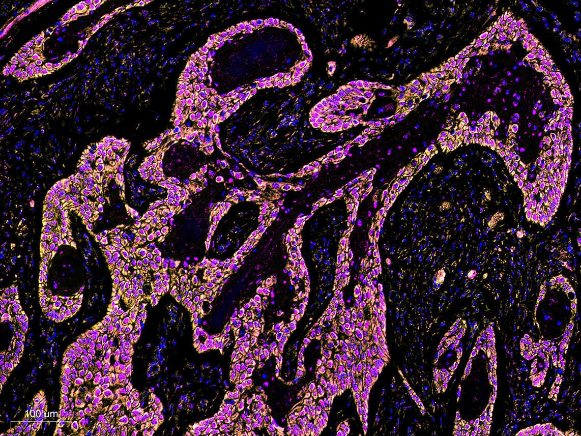 免疫熒光雙標(biāo)（芯片）