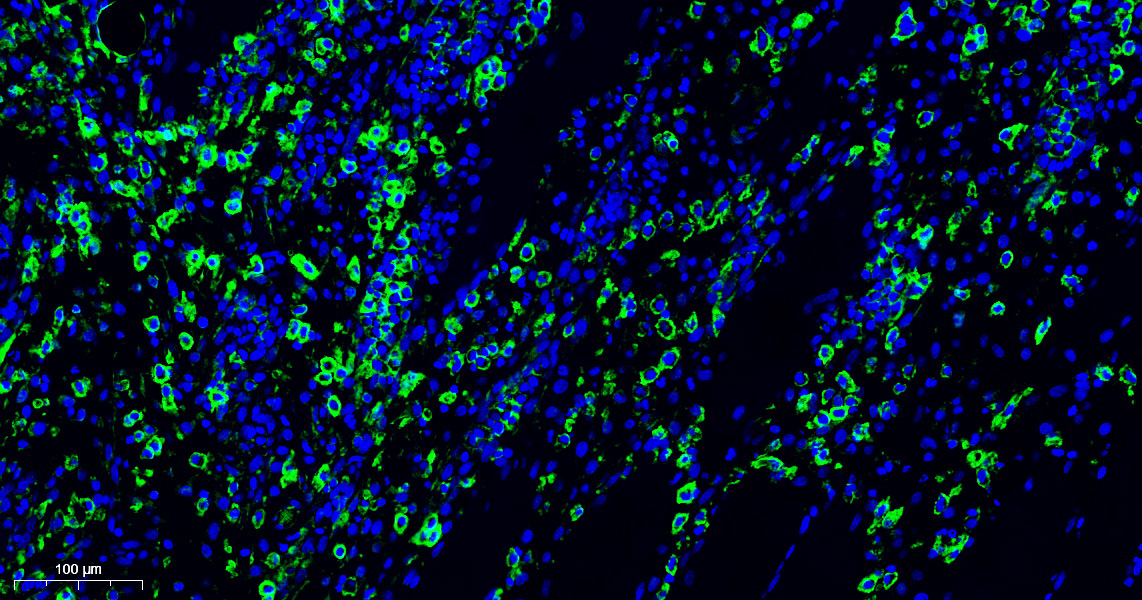 免疫熒光單標(biāo)（芯片）