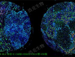 H-Score分析（芯片）