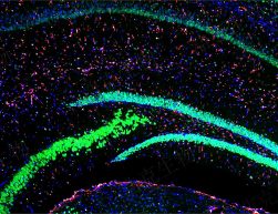 免疫熒光三標(biāo)（芯片）