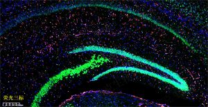免疫熒光三標(biāo)（芯片）