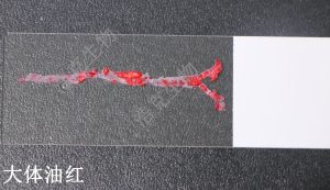 大体油红O染色