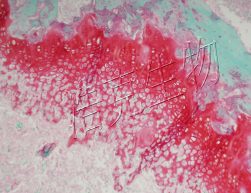 番红固绿染色（软骨）