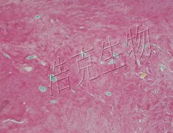 番红固绿染色（软骨）