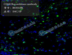 CD68 Recombinant antibody