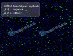 CD163 Recombinant antibody