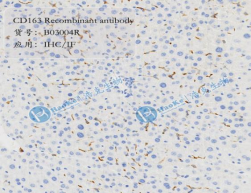 CD163 Recombinant antibody
