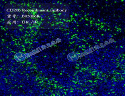 CD206 Recombinant antibody