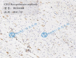 CD3 Recombinant antibody