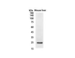 CD3 Recombinant antibody