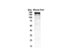 CD163 Recombinant antibody
