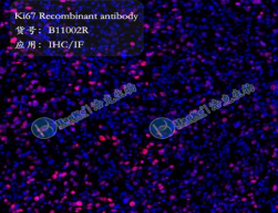 ki67 Recombinant antibody