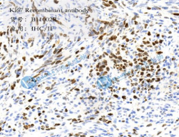 ki67 Recombinant antibody