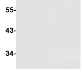 CD206 Recombinant antibody