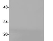 Iba1 Recombinant antibody