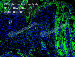 ZO-1 Recombinant antibody