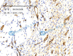 CD31 Recombinant antibody