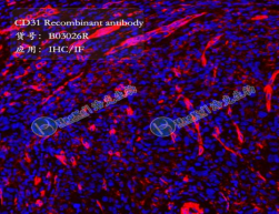 CD31 Recombinant antibody