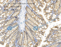 Claudin 1 Recombinant antibody