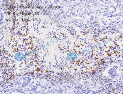CD4 Recombinant antibody