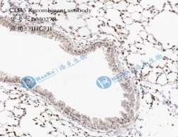 CD45 Recombinant antibody