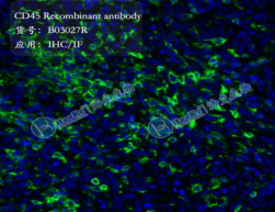 CD45 Recombinant antibody