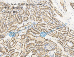 E-Cadherin Recombinant antibody