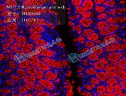 MUC2 Recombinant antibody