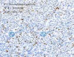 P53 Recombinant antibody