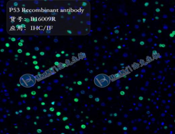 P53 Recombinant antibody