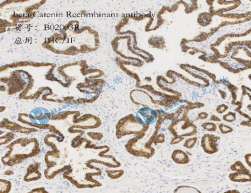 beta-Catenin Recombinant antibody