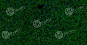 探针设计合成-2OD(两端标记、DIG)