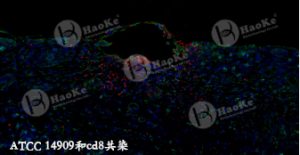 原位雜交(FISH和抗體共染) 原位雜交(FISH和抗體共染)