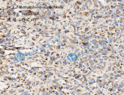 BCL2 Recombinant antibody