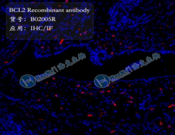 BCL2 Recombinant antibody