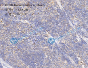 LC3B Recombinant antibody