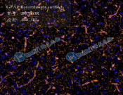 GFAP Recombinant antibody